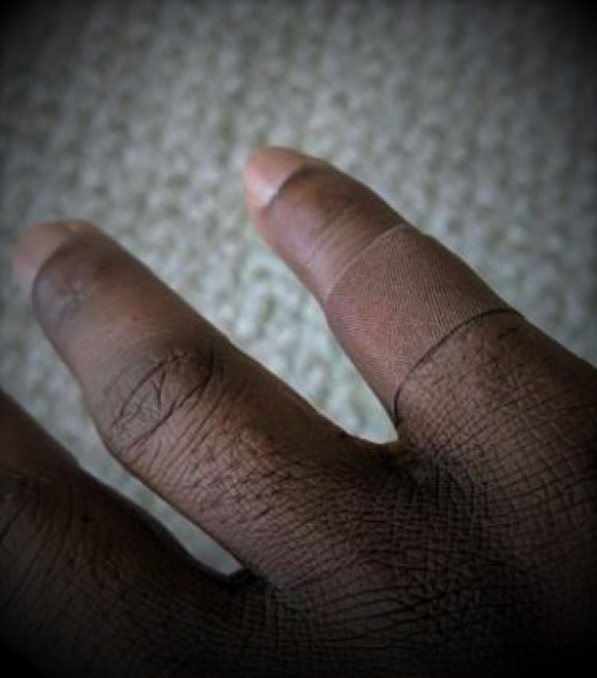 Band-Aid_