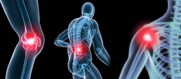 osteoartrite