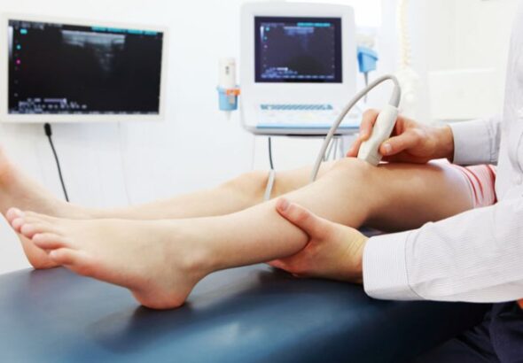 doppler-vascular1